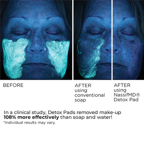 Nassif Detox Facial Pads - Original